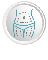 Liposuction
